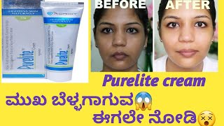 Purelite cream information in kannadaUsesside effects healthcare595 viral skincareroutine [upl. by Cerelly]