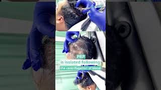 PRP  DHI Bangladesh  LaserTreat [upl. by Solram925]