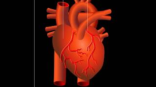 Attaque cardiaque infarctus du myocarde [upl. by Ahsiekyt346]