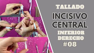 Tallado de incisivo central inferior derecho  Odontologia con Cri [upl. by Asiar]