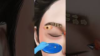 Asmr eyebrow piercing infection treatment shorts animation skincare transformation [upl. by Legna]