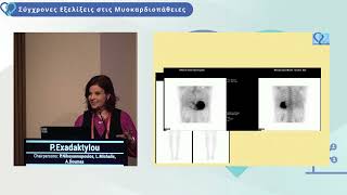 P Exadaktylou  Scintigraphy [upl. by Swagerty930]