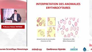 Interprétation d’Hémogramme dans un Laboratoire d’Hématologie [upl. by Nollek988]