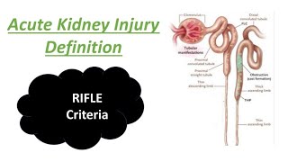 Acute Kidney Injury  RIFLE criteria  AKI  ARF  AKF  Definition  Mightymedicoz [upl. by Ordisi]