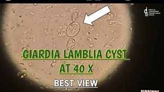 Giardia Lamblia cyst view at 40 XBest microscopic view of giardia cystgiardia parasite in stool [upl. by Ilyse233]