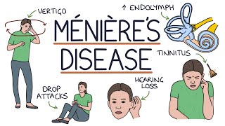 Understanding Ménière’s Disease [upl. by Thilda]