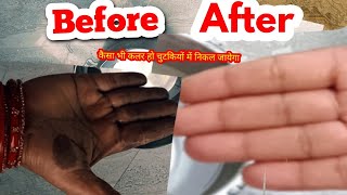 How to Remove Hair Dye from skin घंटो का काम मिंटो अब डाइ हाथो से निकले चुटकियों मे ये ट्रिक देखलो [upl. by Cristin522]