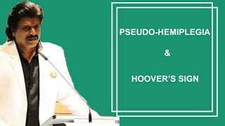 PSEUDOHEMIPLEGIA amp HOOVERS SIGN [upl. by Baxter]