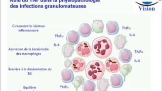 Physiopathologie et Traitement du Psoriasis Biothérapie Spondylarthropathies [upl. by Enitnemelc]