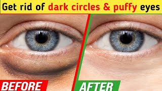 Only 6 mins Eye rejuvenation  Get rid of under eye wrinkles dark circles eye bags Crows feet [upl. by Anaugahs899]