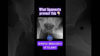 What ligaments prevent the anterior dislocation of hip joint shorts drsamsanatomyclasses [upl. by Keraj]