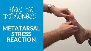 How to diagnose metatarsal stress reaction and fracture [upl. by Morgana]