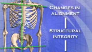 Chiropractor Goldsboro NC  Atlas Orthogonal Chiropractic Specialty at Chiropractic First [upl. by Hanaj]