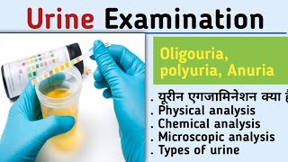 Urine examination physical chemical microscopic examination of urine urine analysisKiran maurya [upl. by Aibara]