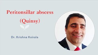 Peritonsillar abscess Quinsy Dr Krishna Koirala  MCOMS Pokhara Dr Krishnas ENT Lectures [upl. by Anital]