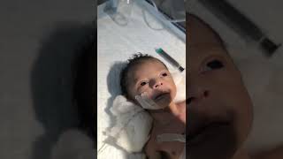 Chestryped for newborn baby😌 sumitnicunursingstm youtubeshorts nursing newbornbaby chestworkout [upl. by Phillane50]