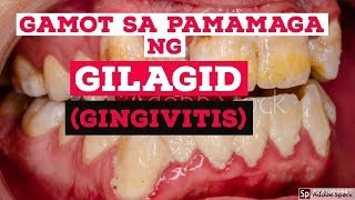 Gamot At Lunas Sa Pamamaga Ng Gilagid [upl. by Nalehp]