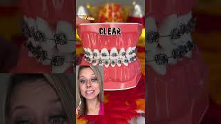 🚨 AVOID THESE BRACES COLORS EXPLAINED 🦷 TIP FOR FALL [upl. by Ynohtnacram]