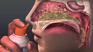 Can Saline Irrigation Help Nasal Allergies Animated Guide to Saline Nasal Irrigation [upl. by Janelle115]