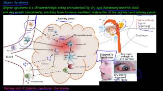 101P  What is Sjögren Syndrome [upl. by Camellia]