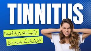 What is Tinnitus Causes Symptoms and Effective Treatment for Ringing in the Ears  NHC [upl. by Mezoff]