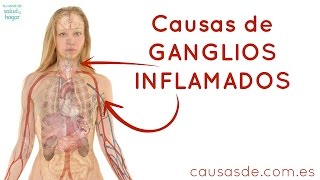 Causas de ganglios inflamados [upl. by Yaral]