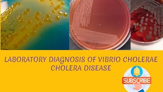 Laboratory diagnosis of Vibrio cholerae in hindi [upl. by Cranston103]