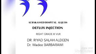 Deflux Injection [upl. by Anwadal]