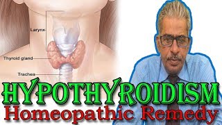 Hypothyroidism in Hindi  Discussion and Treatment in Homeopathy by Dr PS Tiwari [upl. by Henricks]