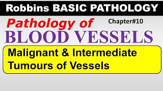 Ch10  Malignant amp Borderline Tumours of Vessels  Blood Vessel Pathology  Robbins Lectures [upl. by Azaria]