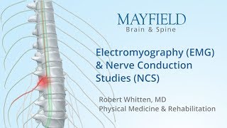 Electromyography EMG amp Nerve conduction studies NCS [upl. by Elvira]