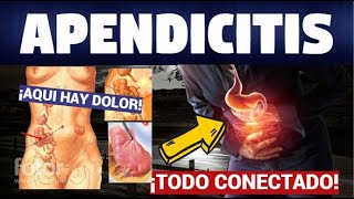 TODO SOBRE APENDICITIS síntomas fisiopatología y tratamiento [upl. by Loma]