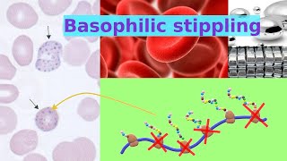 basophilic stippling [upl. by Karlene839]