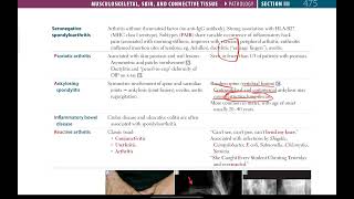 Seronegative Spondyloarthritis Septic Arthritis  Musculoskeletal  26  First Aid USMLE in Urdu [upl. by Ydnyl]