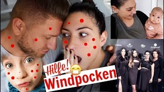 HilfeWindpocken 😷 Das erste Event mit Baby  Familien Vlog MAYRA JOANN [upl. by Lemak]