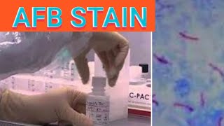 Sputum AFB stain procedure Acid fast staining Sputum staining procedure  laboratorymicrobiology [upl. by Sachiko113]