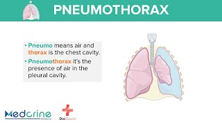 Pneumothorax Definition Types and classification Preview [upl. by Otirecul428]