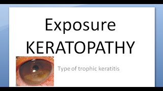 Ophthalmology 124 a Exposure KERATOPATHY Keratitis Causes Corneal Dry [upl. by Latsyek]