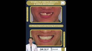 Best Dental Optical Clinic Manila Philippines [upl. by Sale]