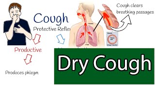 Dry cough Chronic cough causes and treatment [upl. by Landy871]