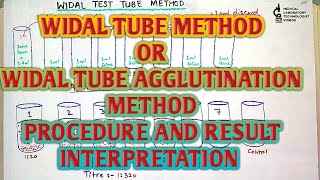 Widal test tube or tube agglutination or tube titration methodprocedure and result interpretation [upl. by Luy]