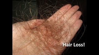 Doctor Discusses Most Common Cause of Sudden Hair Loss [upl. by Enehs]