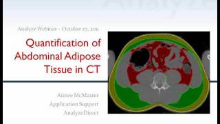 Quantification of Abdominal Adipose Tissue from CT using Analyze 100  Webinar [upl. by Etteb225]