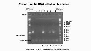 Visualization of Gel Electrophoresis [upl. by Nottnerb628]