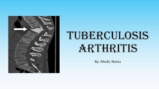 Ortho Tuberculosis arthritis  TB in joints spine TB gibbus deformity investigation treatment [upl. by Kenlee]