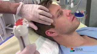 “Le doppler transcranien en pratique”  7 minutes pour tout savoir [upl. by Atirma]