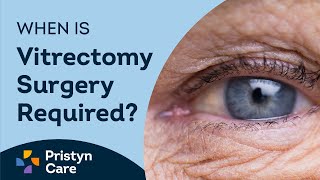 What is Vitrectomy Surgery  Pristyn Care [upl. by Leith]