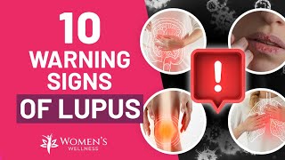 10 Vital Warning Signs of Lupus [upl. by Alram]