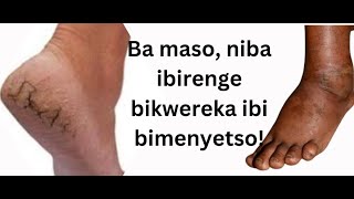 Dore icyo urwaye niba ibirenge byawe bigaragaraho ibi bimenyetso [upl. by Ynafets112]