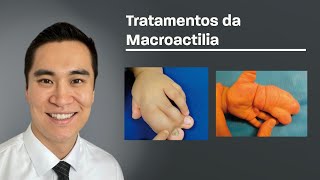 Tratamento cirúrgico da Macrodactilia [upl. by Rasecoiluj]